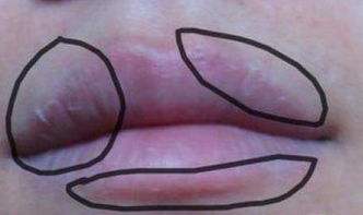 嘴唇干燥有唇炎用哪种唇膏好,唇炎可以用的唇膏推荐