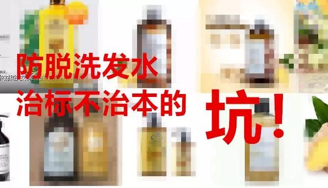 头油头皮屑多脱发洗发水,头油头皮屑多洗发水推荐