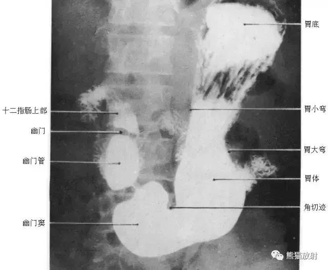 「收藏」11种消化道造影解剖图谱