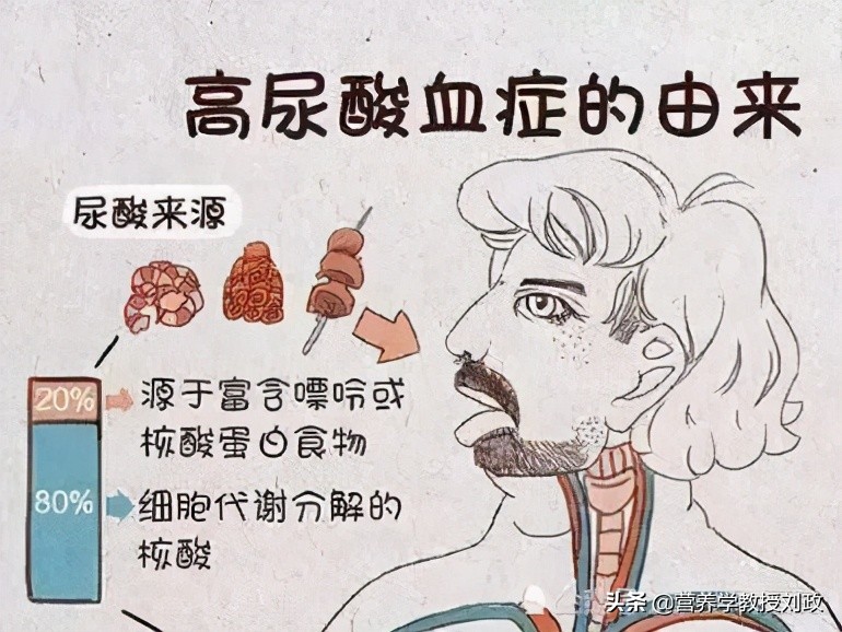 高尿酸血症与痛风诊疗膳食指导,成人高尿酸血症与痛风食养指南