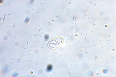 犬贾第鞭毛虫简介,犬贾第鞭毛虫