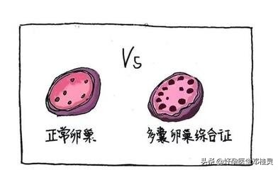 去医院检查说我有多囊卵巢综合症,患有多囊卵巢综合症能治好吗