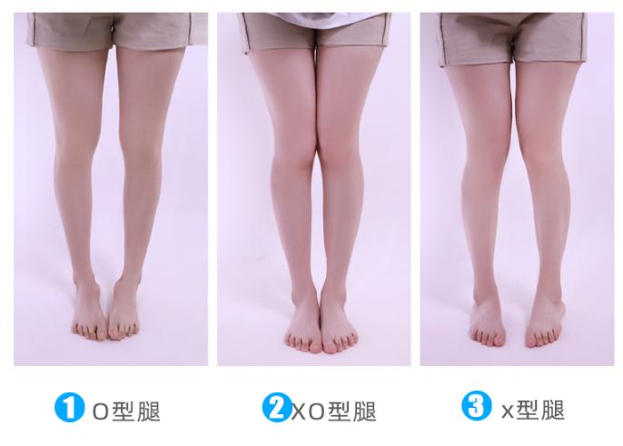 o型腿穿什么矫正好看,o型腿的穿搭方法