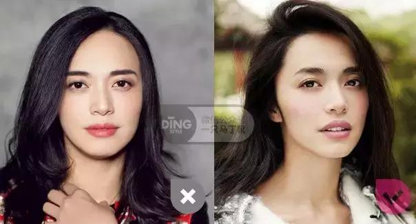 颅顶太低如何自救,颅顶低怎么自救