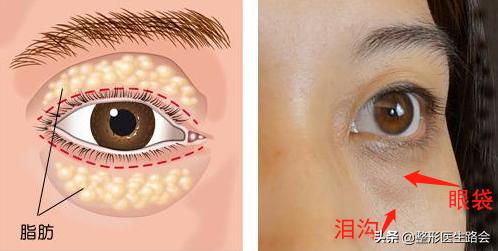 关掉美颜黑眼圈,关掉美颜眼睛更清纯