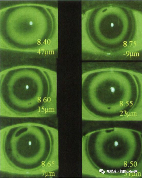 视光冷知识|OK镜的荧光评估靠谱吗？