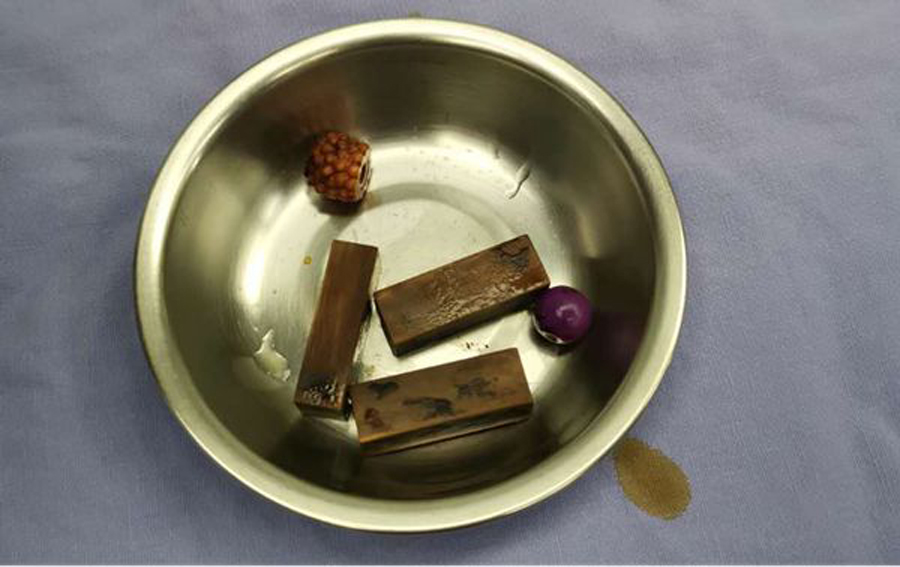 女童因隐私部位异常住院！性教育要趁早，不要让难以启齿害了孩子