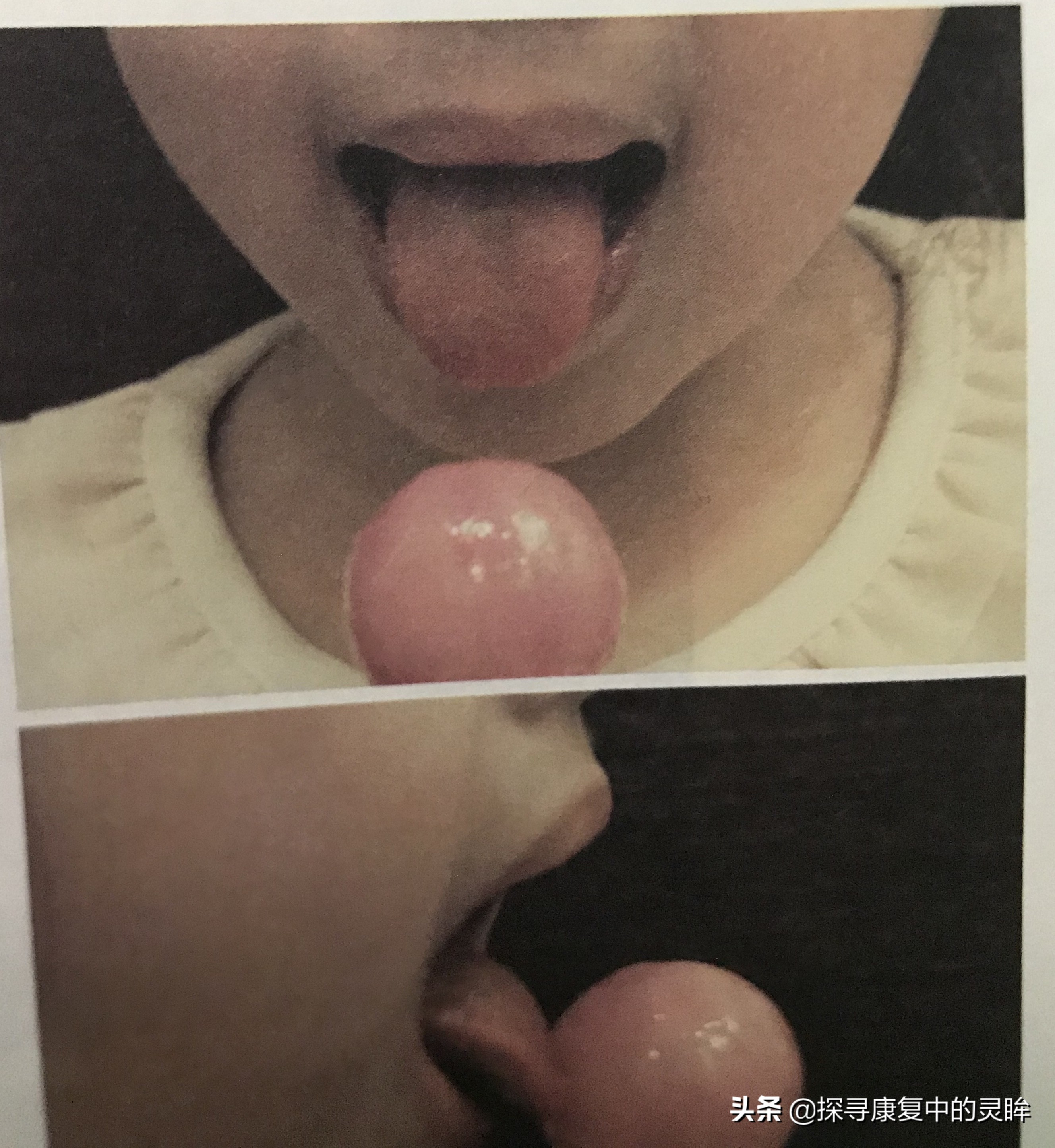 五种口部运动：灵活孩子的樱桃小嘴，让他们说话更清晰（超简单）