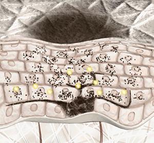 女人打美白针会变白吗,长期打美白针对身体有危害吗