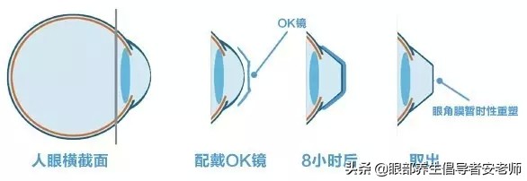 ok镜的真相也许没那么简单,关于ok镜的新闻事件