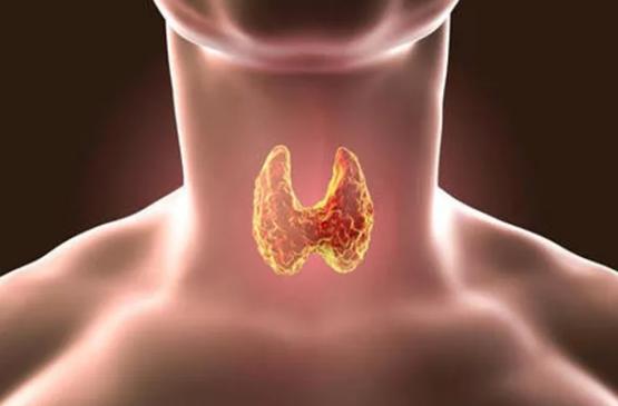 怎么帮助甲亢患者调整心态,如何预防甲亢最有效的方法