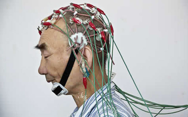 精神性疾病狂躁症,癔症性精神疾病