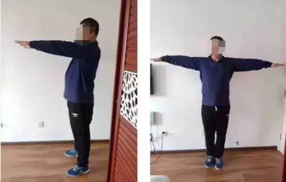 慧眼识疾开滦总医院成功挽救“健康人”