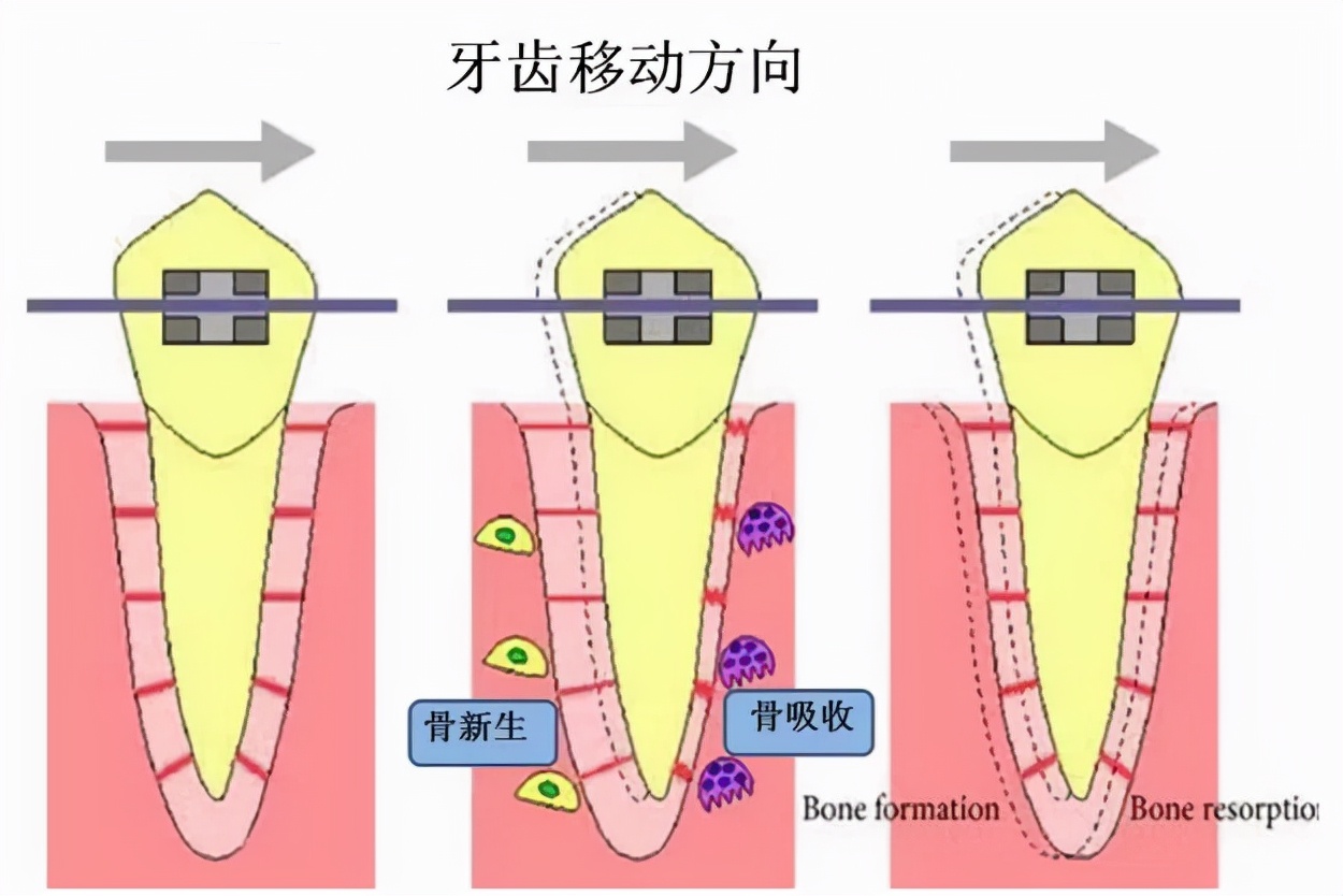牙根痒痒像塞东西似的怎么回事,牙根痒痒的老想咬东西怎么回事