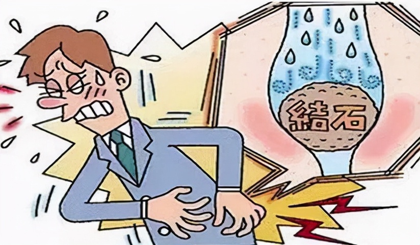 9毫米结石可以用冲击波打碎吗,体外冲击波治疗多大结石可以碎