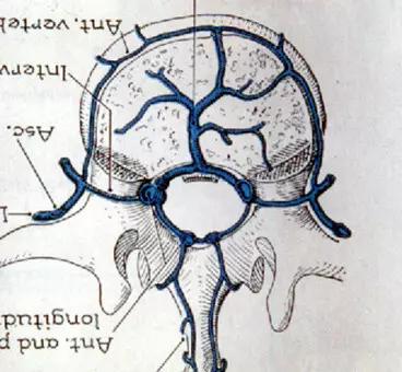 颈椎腰椎疾病ct及mri诊断,腰椎ct可以发现肠部病变吗