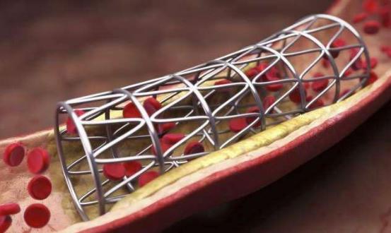 西洋参心脏病能不能喝,心血管疾病适合吃西洋参吗