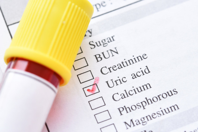 痛风发作天天要吃止痛药,痛风发作吃止痛药副作用