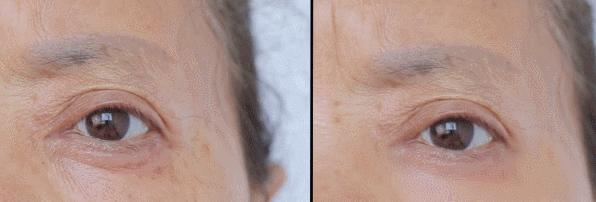 眼霜有必要用好一点的么,眼霜一般有没有用