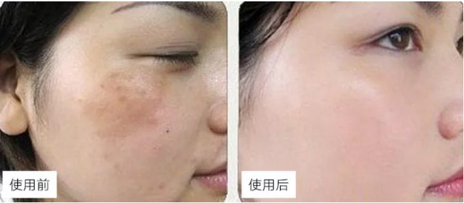 6款因太丑被误解的老国货,好用又便宜的就属这5款老国货