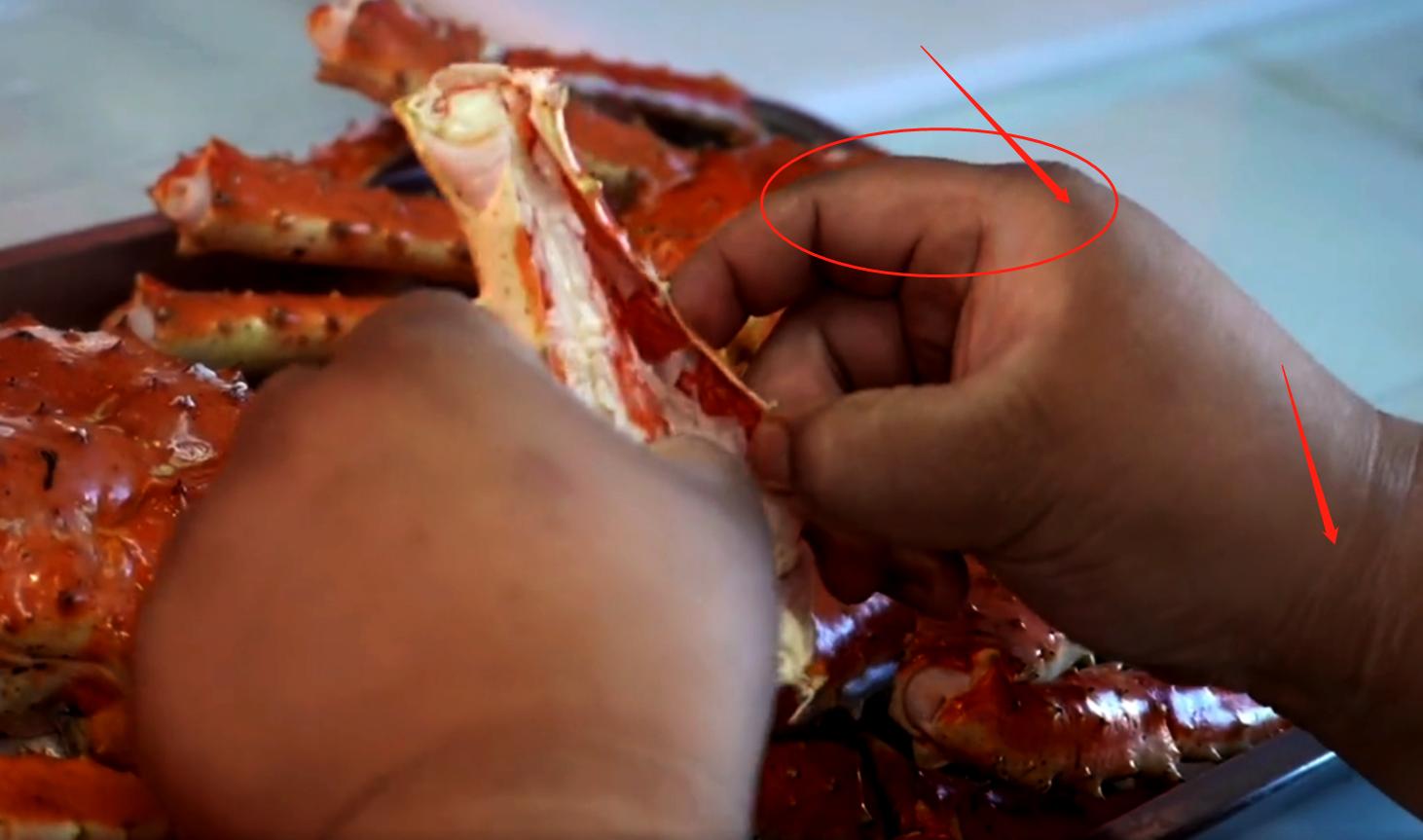 胖猴仔满脸黑斑,胖猴仔身体发黑