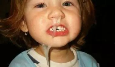 孩子老有流不完的鼻涕是咋回事,小孩没感冒老是流鼻涕怎么回事