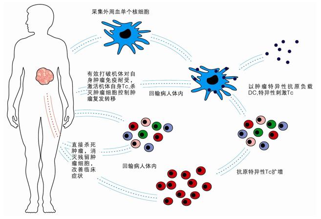 七旬大爷身体疾病,大爷患癌十年如今依然健康