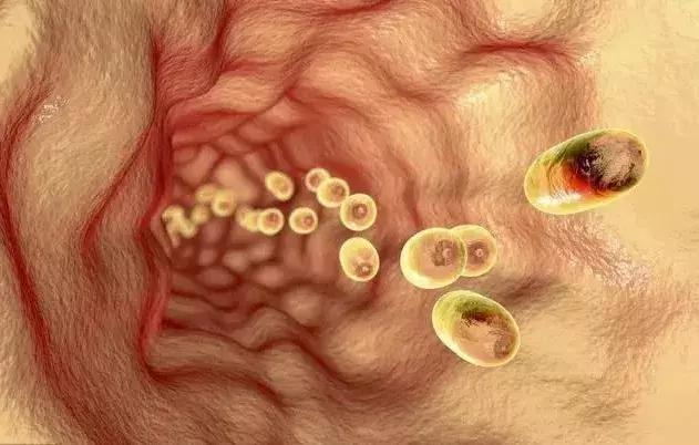 肿瘤压迫气管呛咳怎么缓解,肿瘤患者吞咽困难了怎么回事