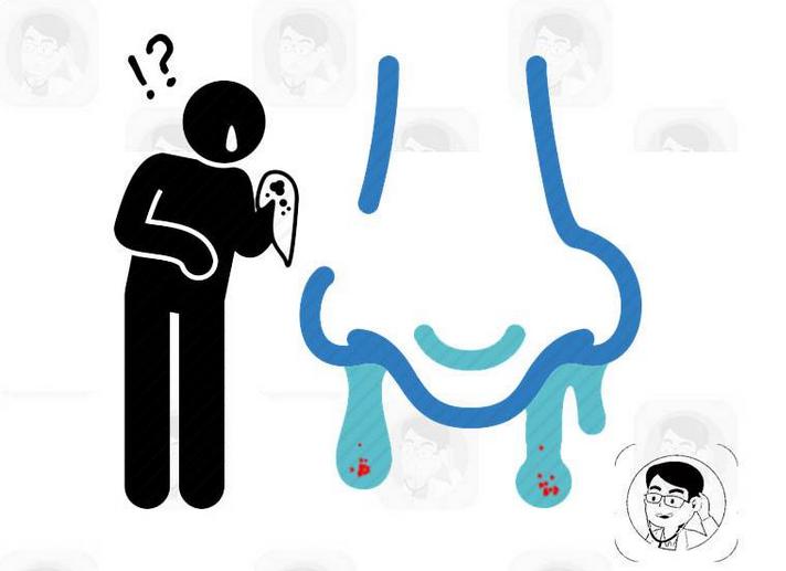 流鼻血怎么办教你一招解决,流鼻血怎么办教你一个动作