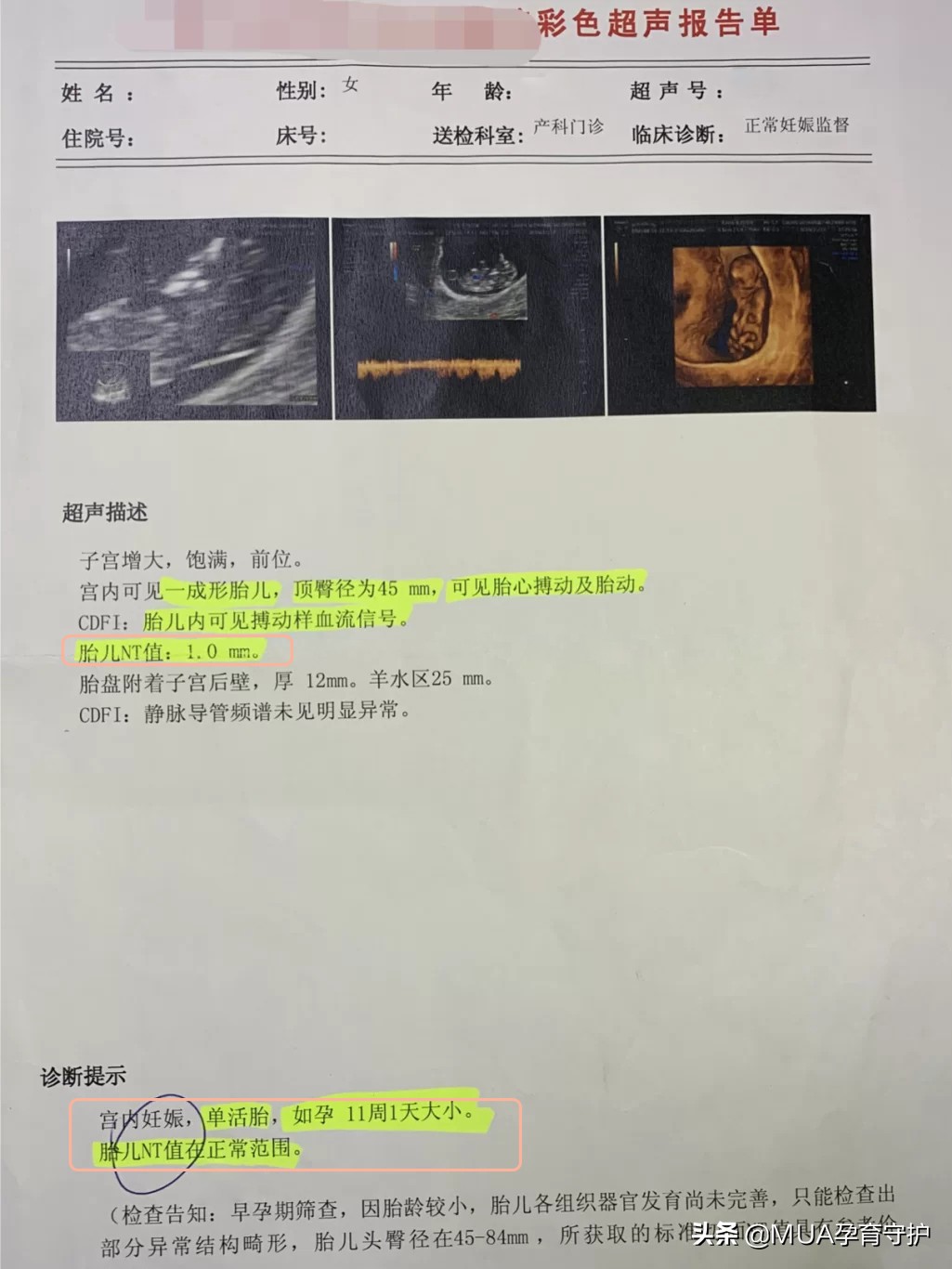 医生不告诉预产期是多少怎么办,孕早期检查医生不会告诉你的事