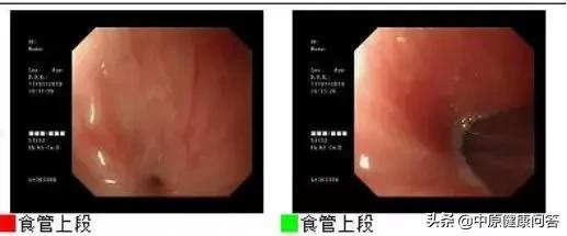 家人将清洁油烟机的油烟净装到脉动瓶里，被6岁男孩误喝