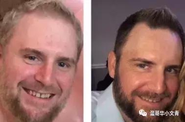 甲状腺癌手术后需要吃抗癌药物吗,治甲状腺癌有什么特效药