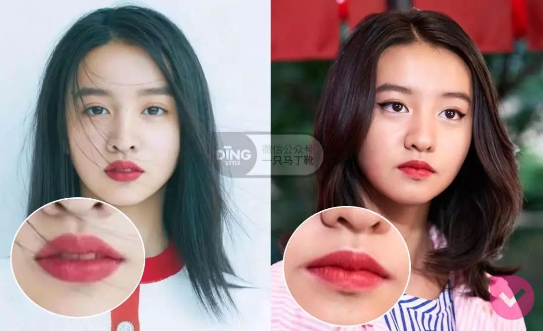 戴牙套凸嘴怎么化妆,凸嘴整牙削骨吗