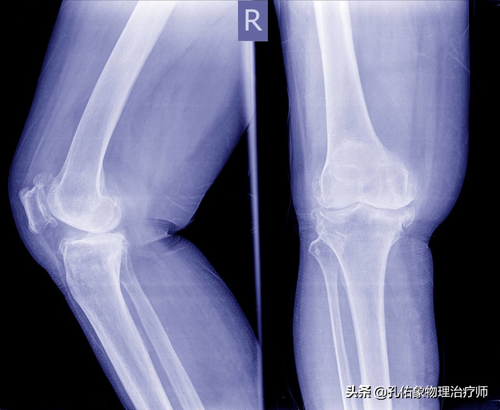 膝痛一招教你解决,膝痛怎样锻炼