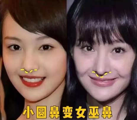 好看的鼻子类型驼峰鼻,好看的鼻型有哪几种