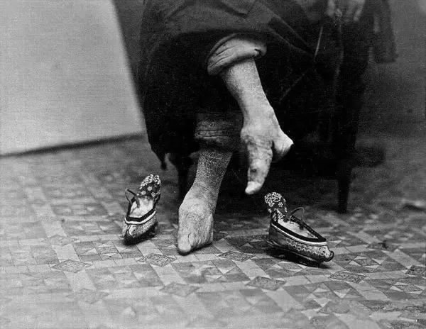 实拍三寸金莲裹脚缠足全过程,三寸金莲的缠足过程