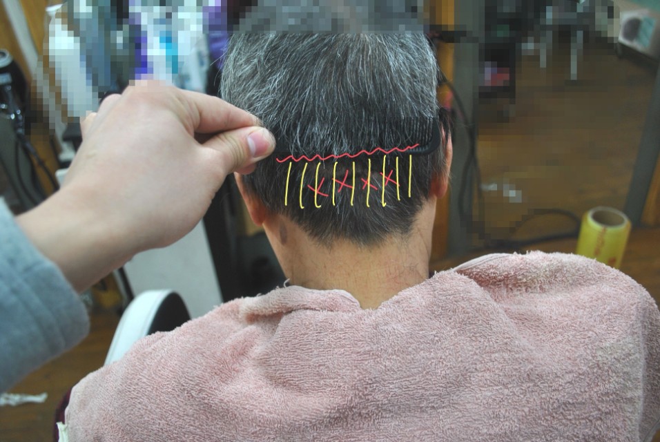 遮盖白发头顶的假发,假发遮盖白发发型