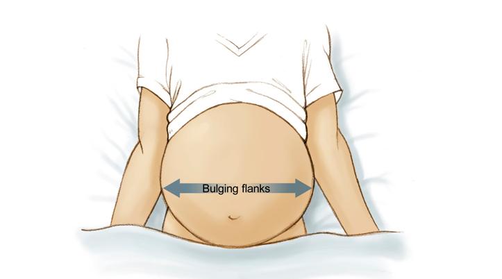 小腹胖的很快是什么原因,小腹变大是肝脏不好吗