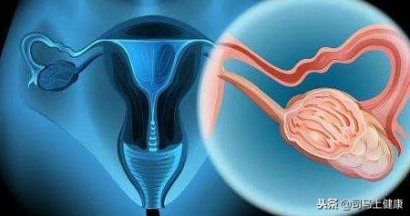 什么是子宫颈癌？它有哪些临床表现？中医是怎样认为的？