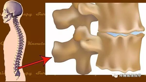72岁老人腰疼还有骨刺该怎么治疗,老年人骨刺疼痛怎么治疗