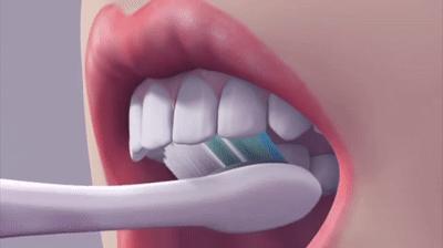 哪种牙膏去黄牙美白效果最好,用什么牙膏去黄美白效果最好