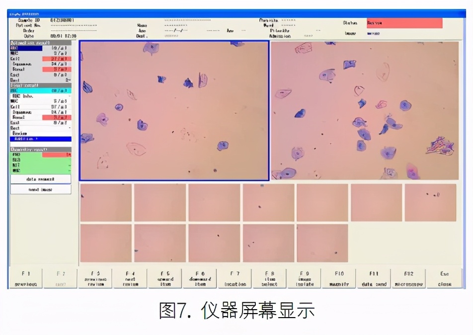 尿液有形成分分析的应用进展,尿液染色方法