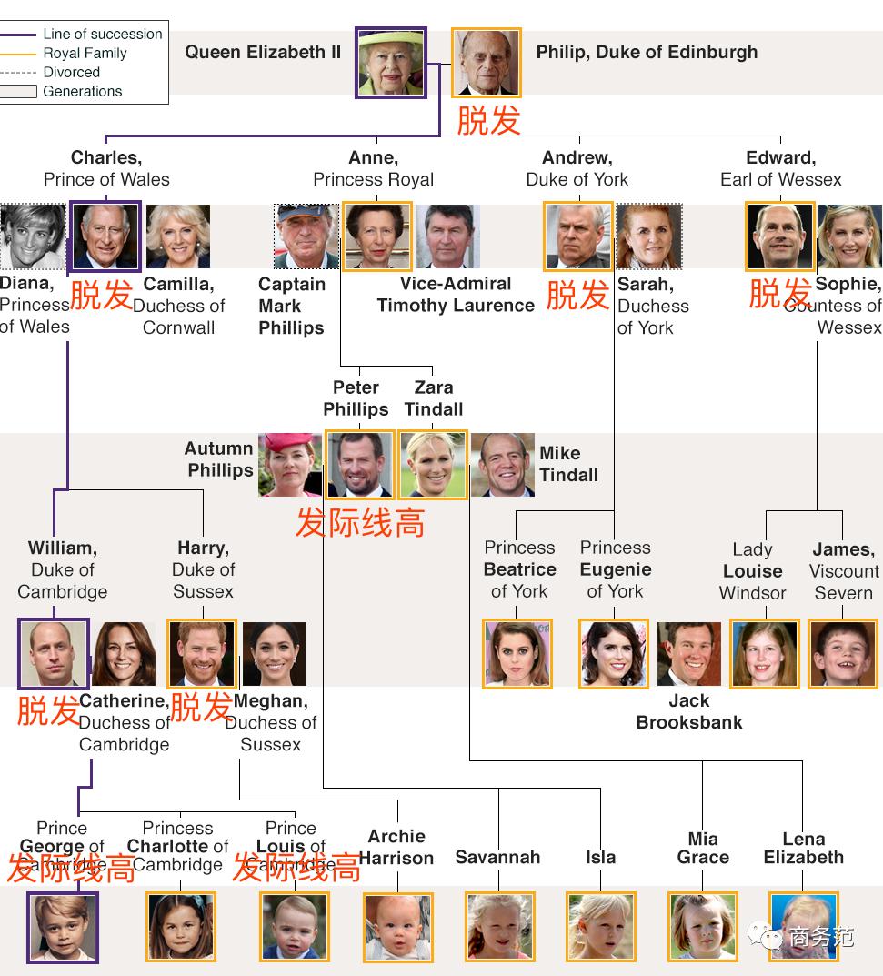 威廉王子秃顶了哈里为啥没秃顶,威廉王子为什么喜欢秃顶