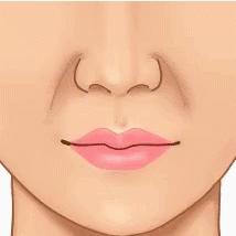 面中部凹陷下巴微翘,朱元璋式下巴怎么矫正