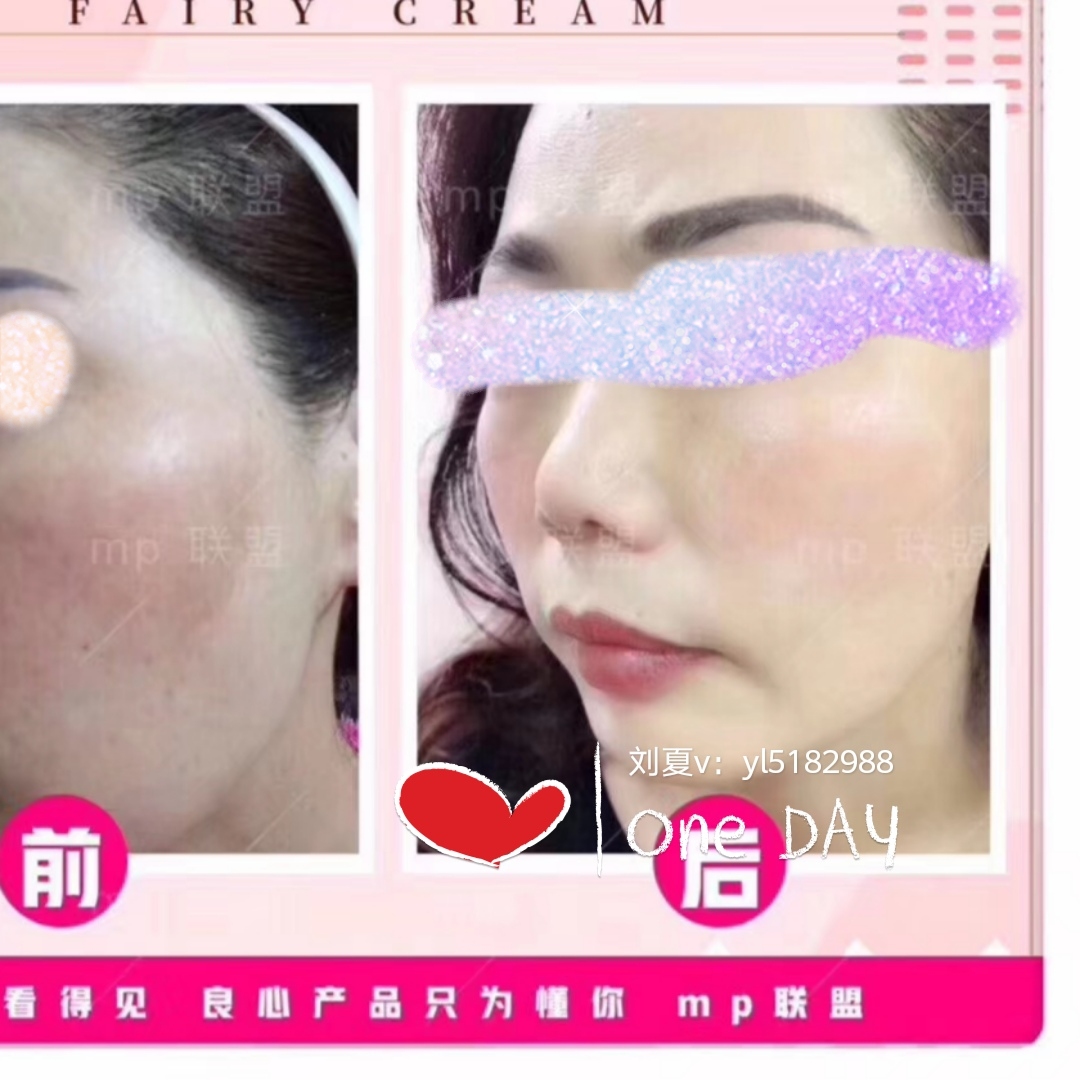 祛斑美肤最有效的滋养霜