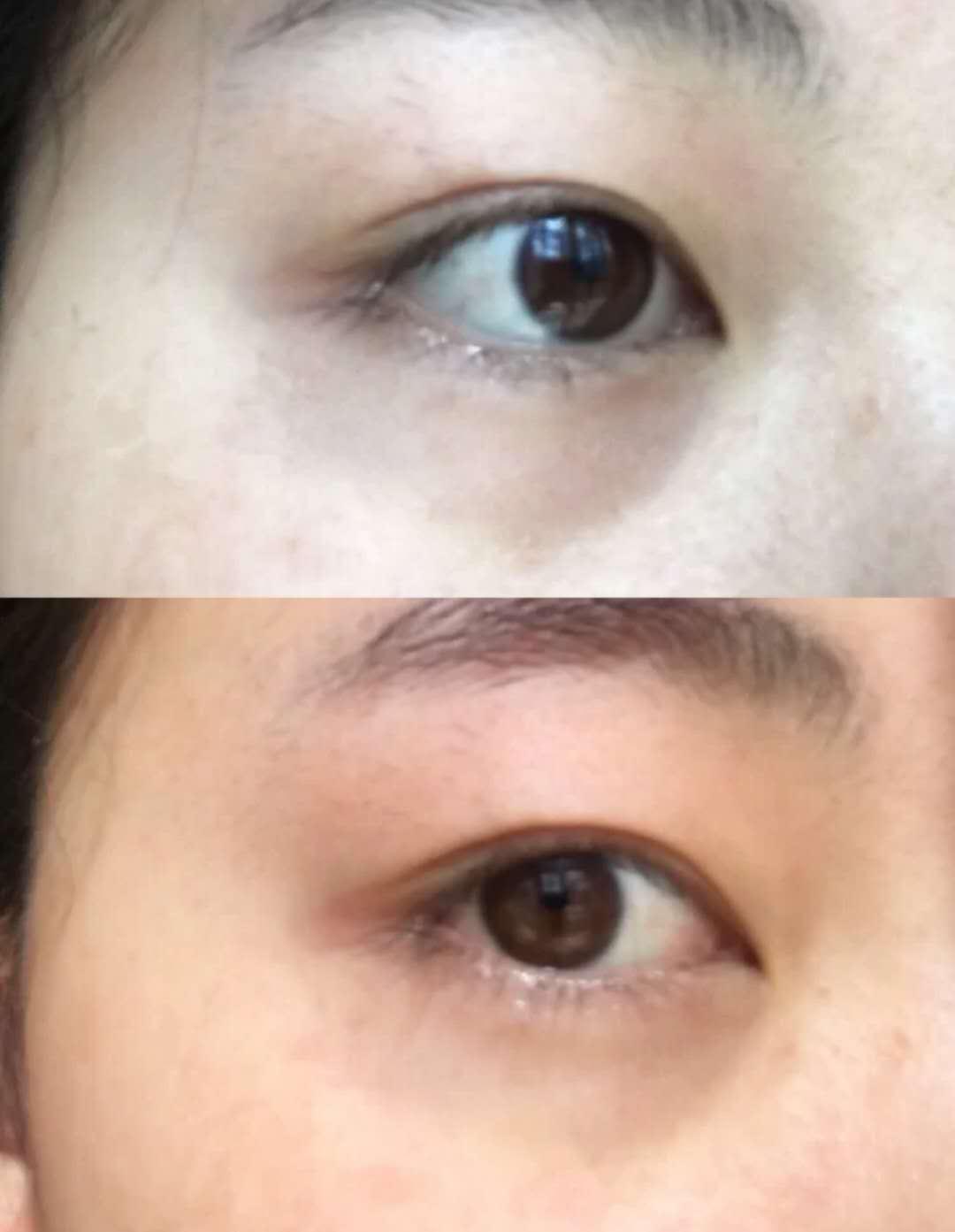 眼下有笑纹的女人好不好,笑纹多的女人意味着什么