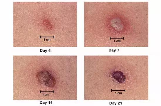 清醒一点，你胳膊上从小就有的那个疤痕，不是被神选中的印记