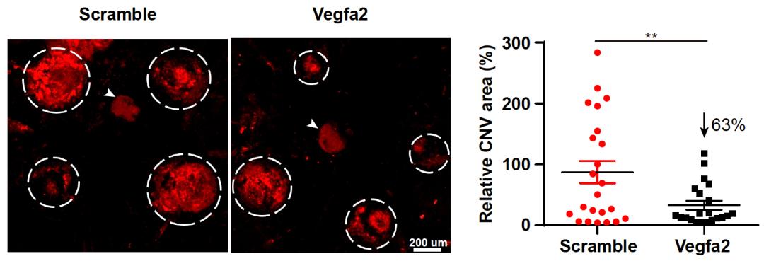 基因编辑技术治疗基因病,已经批准的基因编辑治疗技术