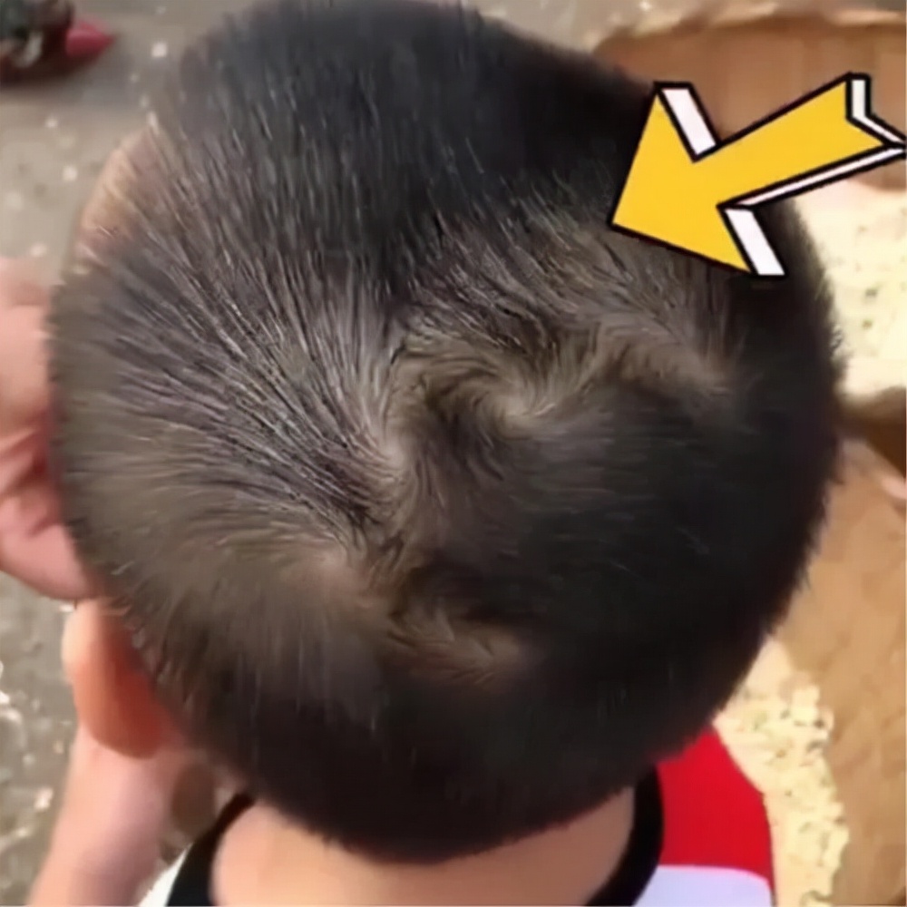 孩子头上的旋代表什么意思,孩子头上的旋到底和什么有关