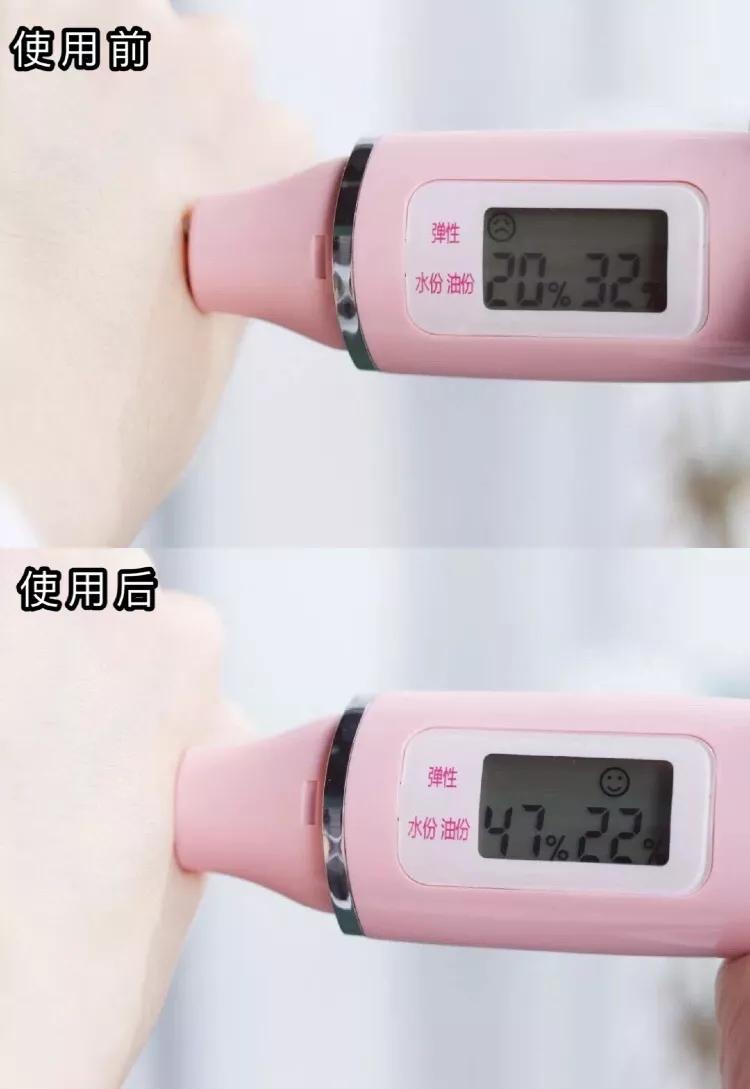 有一种丑叫内分泌失调,有一种丑叫做肤色不均的图片